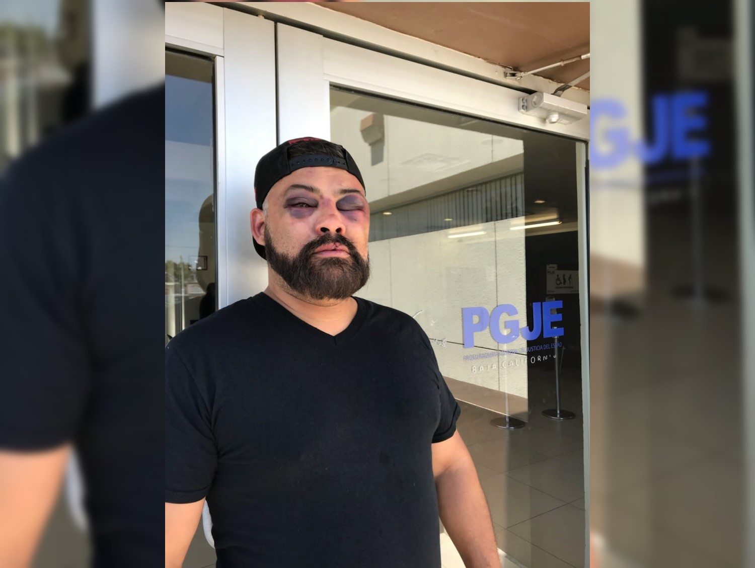 Riebeling da brutal golpiza a abogado