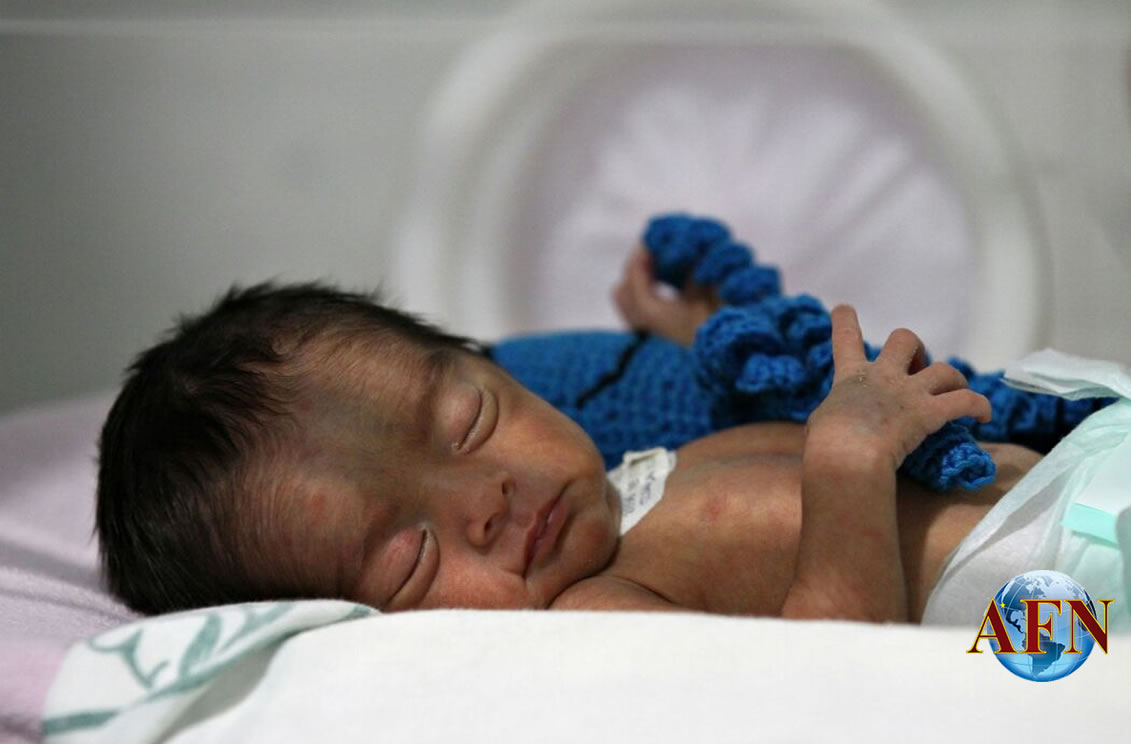 Pulpos para motivar a prematuros