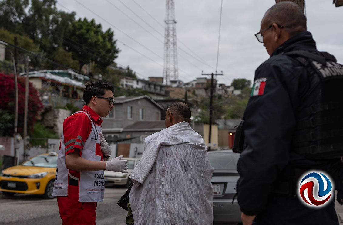 Resultó con quemaduras un hombre en incendio de vivienda